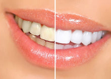 Load image into Gallery viewer, Teeth Whitening Pen